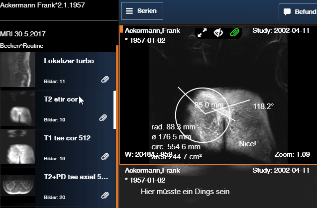 aktive Serie anzeigen